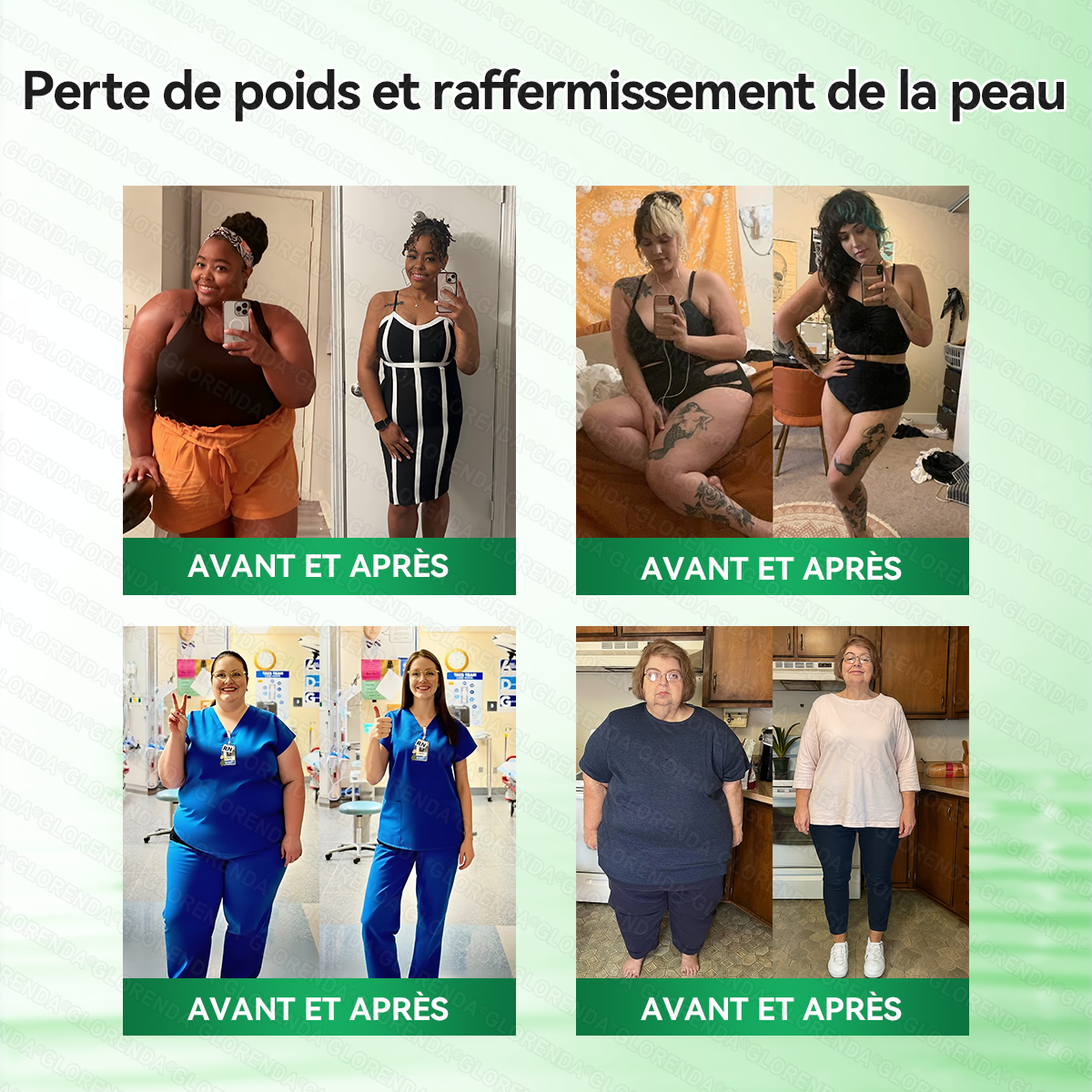 Boutique officielle 🌈🌈 𝐆𝐋𝐎𝐑𝐄𝐍𝐃𝐀® Moringa · Berbérine + NAD+ – Patch Microneedle Nano Avancé 10-en-1 (1×/jour, résultats visibles en 7 jours) | Obésité, relâchement cutané, apnée du sommeil, articulations, etc.